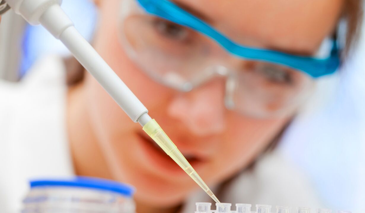 Laboratory analysis of urine - a method of diagnosing prostatitis